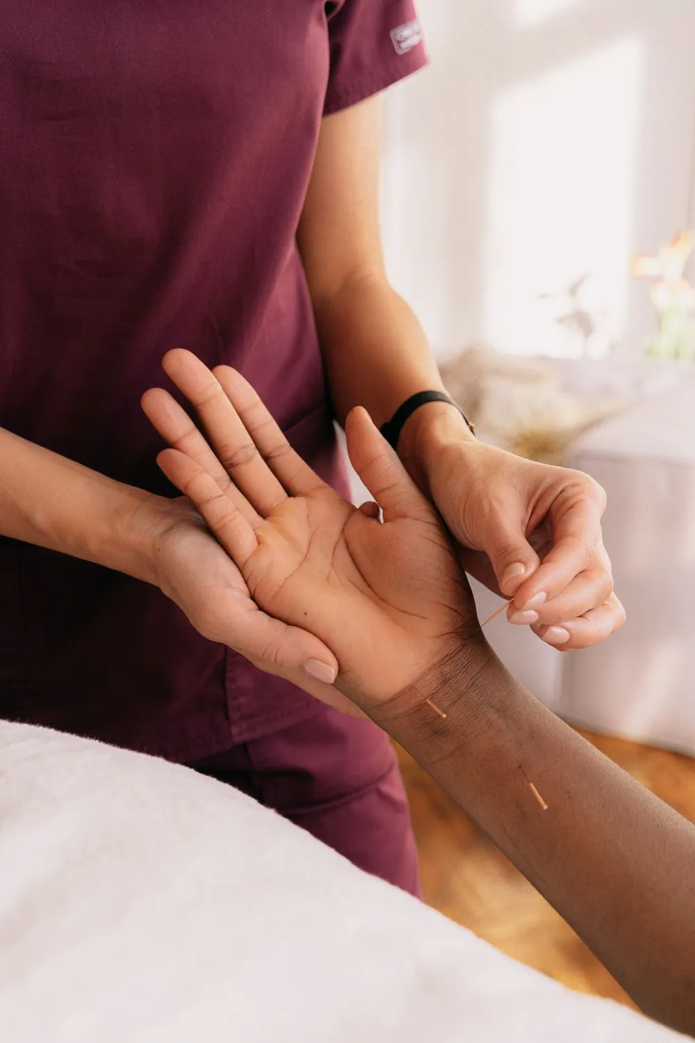 Close-up of a licensed practitioner placing fine acupuncture needles along a patient's forearm in a bright treatment room